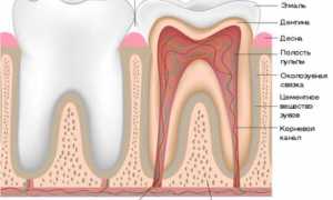 Как чистят каналы зубов