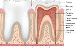 Как чистят каналы зубов
